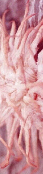 Udskriv 'Pink Anemone' ved at trykke på billedet