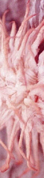 Udskriv 'Pink Anemone' ved at trykke p� billedet